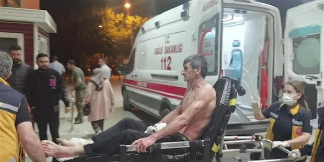 Üzerine asit dökülen işçi ağır yaralandı