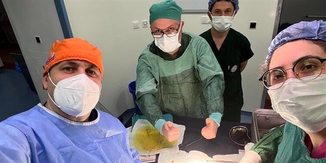 Safra kesesinden 1250 taş çıktı, doktor ismini yazdı