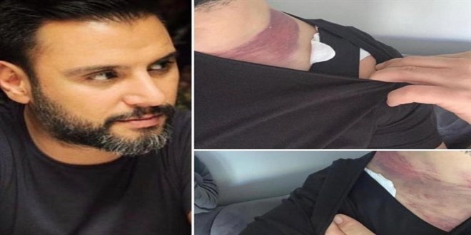 Ali�an'�n doktoruna a�t��� davada e�i tan�k olarak dinlendi