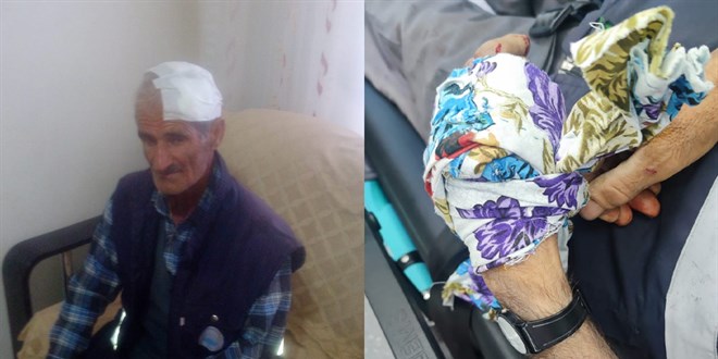 Diyarbakır'da sokak köpekleri yaşlı adama saldırdı