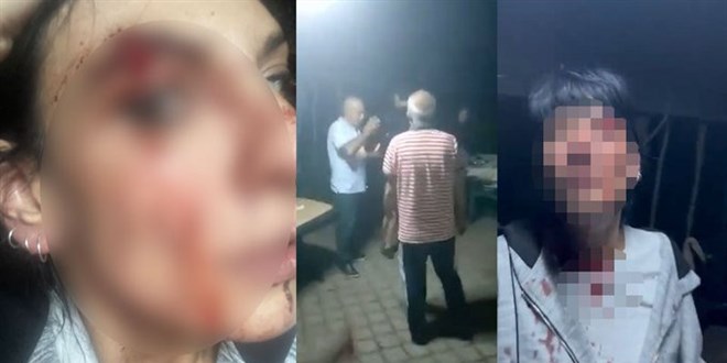 Esenyurt'ta site kamelyasında kadına darp: 2 kişi tutuklandı