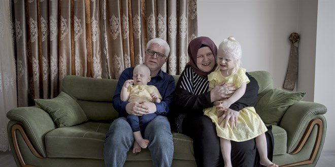 Öğretmen ve müezzin çift kendileri gibi iki çocuklarıyla albinizmlilere örnek oluyor