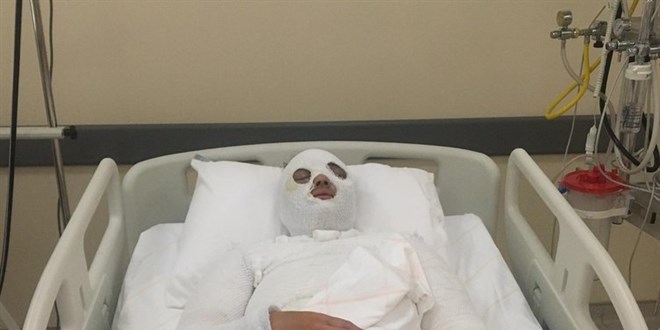 Sözleşmeli er, eski nişanlısına 'su saatine bakacağız' yalanıyla kezzap atmış