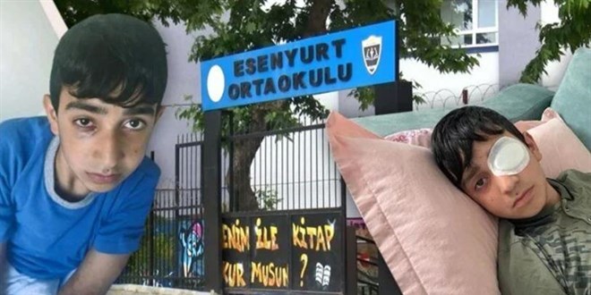 Okulda görme kaybı yaşatan dayak