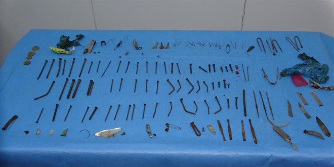 Doktorları şaşkına çeviren ameliyat: Midesinden 158 parça metal çıktı