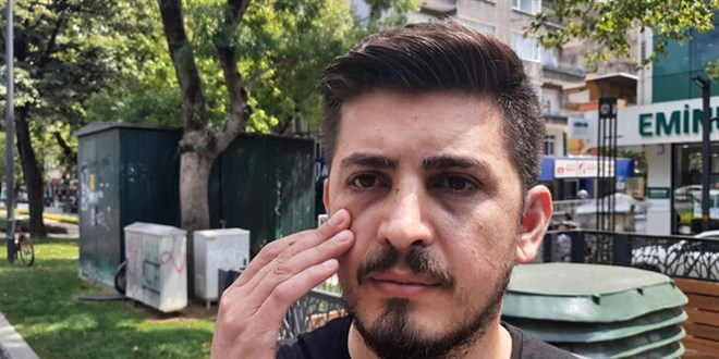 Hastanede hemşirenin burnunu kırdı, adli kontrolle serbest kaldı