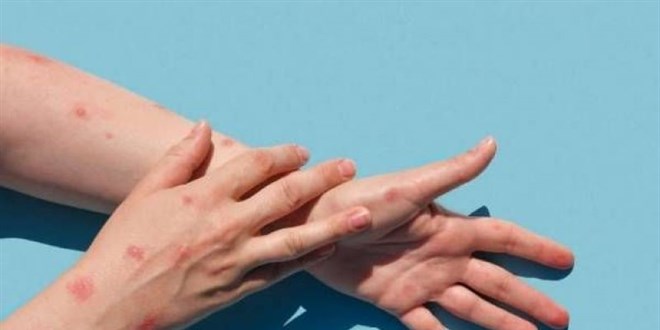 Kocaeli'de traktörün devrildiği kazada 1 kişi öldü, 3 kişi yaralandı