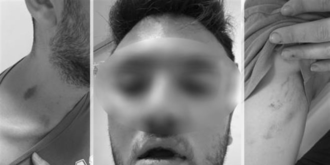 T�p Fak�ltesi ��rencilerine emlak��dan darp ve tehdit iddias�