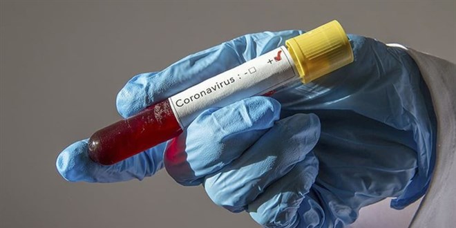 Koronadan 9 ferdini kaybeden ailede genetik bir bulguya rastlanmad�