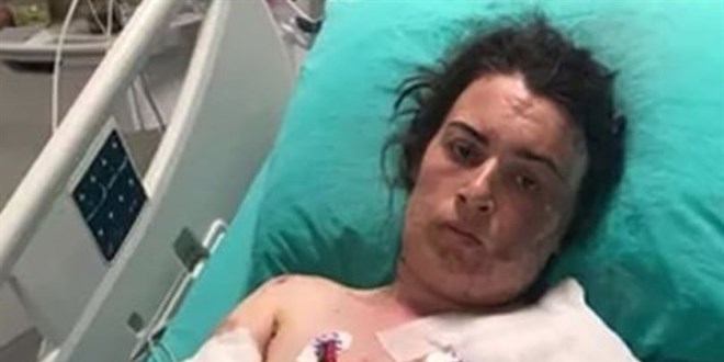 Başsavcılıktan eltisini yaralayan kadınla ilgili açıklama