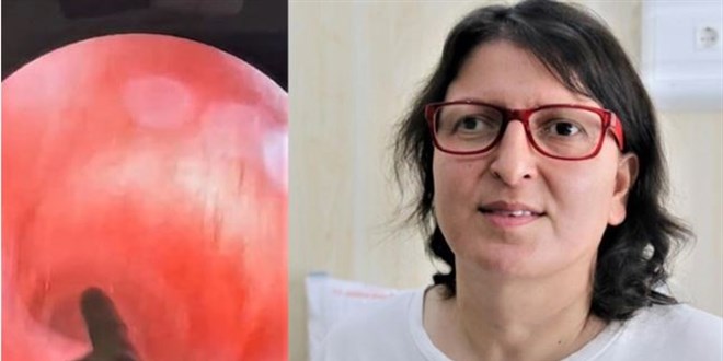Nefes borusundan akciğere indi! Doktora başvuran hemşire şokta