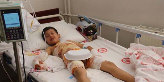 Anaokulunda üzerine sıcak su dökülen çocuk tedavi altına alındı