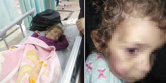 Küçük Firdevs'i darbeden anne tutuklandı, kardeşleri korumaya alındı