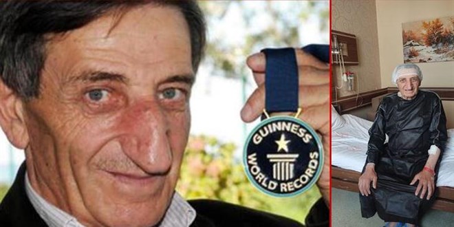 Burnuyla Guinness Rekorlar Kitabı'na girmişti, hayatını kaybetti