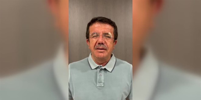 Trafik kazasında yaralanan Nihat Zeybekci'nin tedavisi tamamlandı