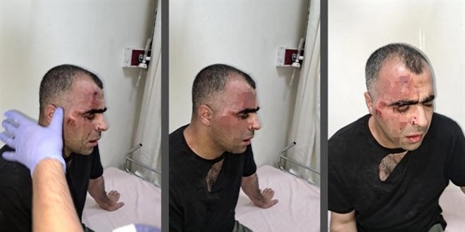 Gazetecinin darbedilmesi olayında polis memuru ve belediye çalışanı tutuklandı