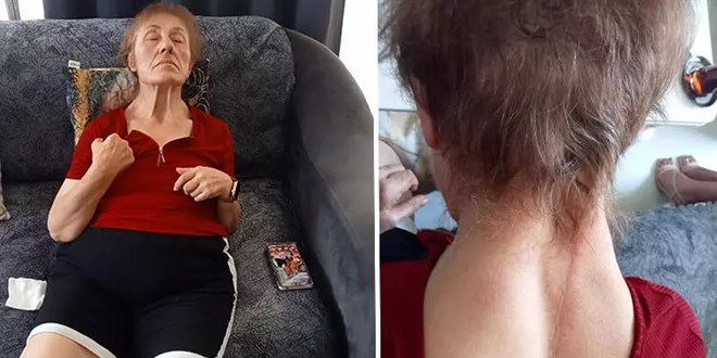 Yürüyerek gittiği özel hastaneden felçli çıktı