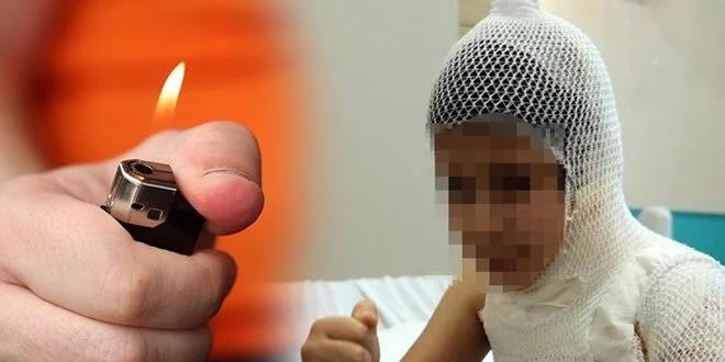 Sosyal medyada tehlikeli akım: Üzerine kolonya döküp yaktı