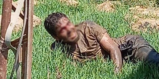 Kuduz hastası hastaneden kaçtı: Vatandaşlar paniğe kapıldı