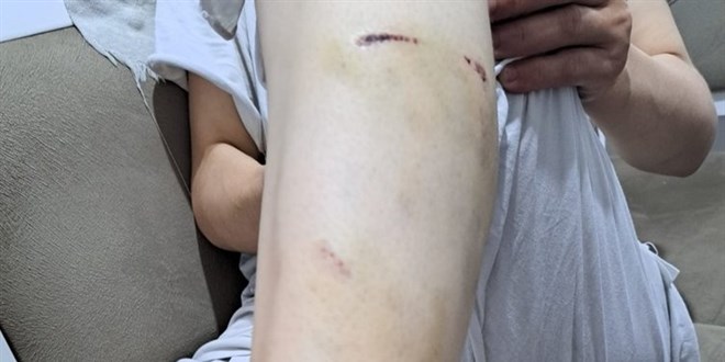 İBB'deki köpek ısırması olayına ilişkin soruşturma başlatıldı