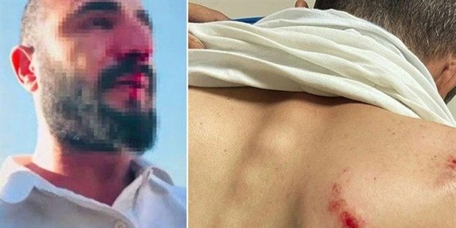 Kaçak elektrik denetimi yapan görevliler darbedildi: 2 gözaltı