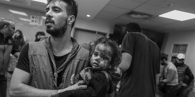 Gazze Salk Bakanl: Elinde yakt bulunanlar hastanelere baa bekliyoruz