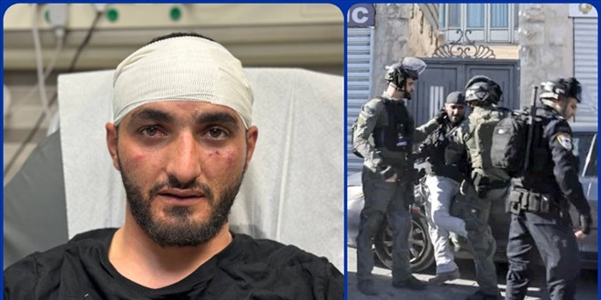 İsrail polisi AA foto muhabirini darp etti. İşte o görüntüler