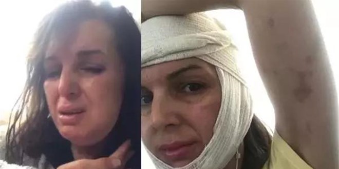 Güzellik merkezinde topuklu ayakkabı dayağı