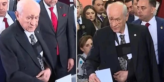 Bahçeli'nin yüzündeki morlukların nedeni belli oldu