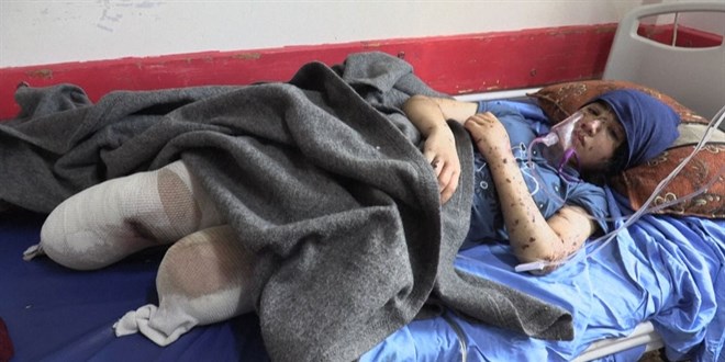srail saldrsnda evlerinde kan yaralanan Filistinli ailenin tek dilei tedavi olmak