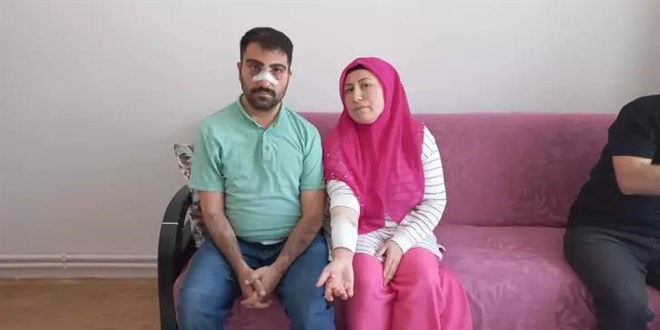 Engelli komşusunun burnunu kırıp, sıcak su ile yakan şüpheli serbest