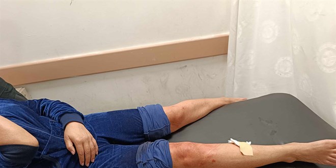 Hatay'da sahipsiz köpeklerin saldırısına uğrayan kadın yaralandı