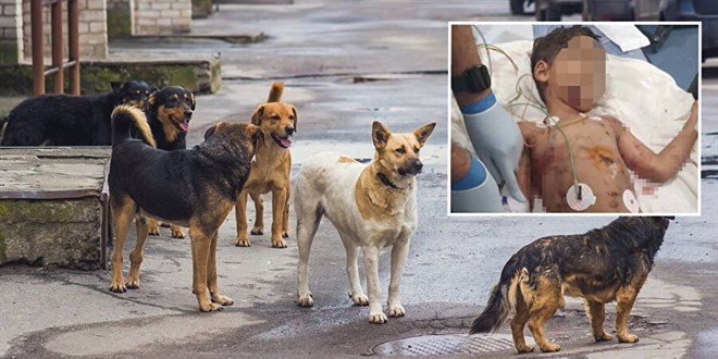 Sokak köpeklerinin saldırısına uğrayan çocuk ağır yaralandı