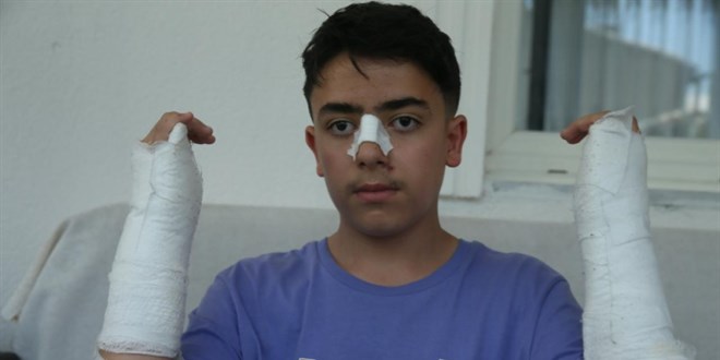 Kars'ta başıboş köpeğin saldırdığı çocuk yaralandı