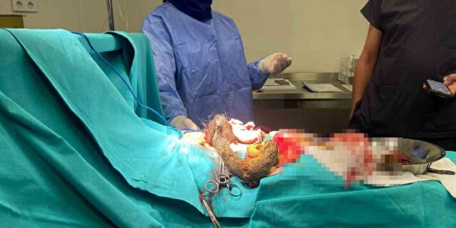 14 yaşındaki kızın midesinden çıkanlar doktorları şoke etti