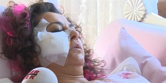 Başıboş köpeklerin saldırdığı akademisyen olay anını anlattı