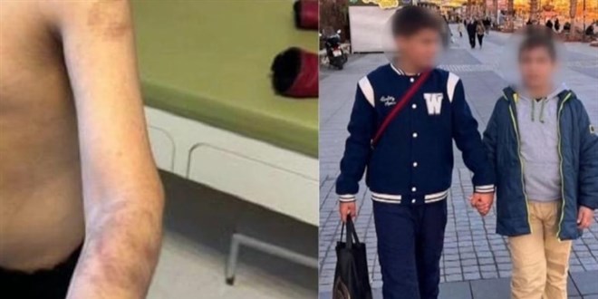 Otizmli çocuğa şiddet iddiasına bakanlıktan açıklama