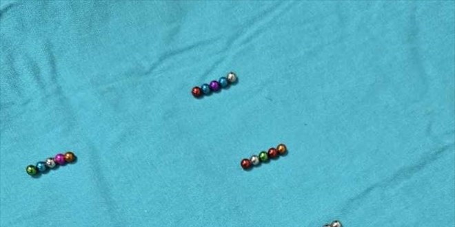 5 yaşındaki çocuğun bağırsağından 38 mıknatıs çıktı