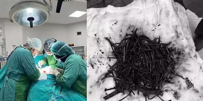 Zihinsel engelli kadın hastanın midesinden 1 kilo metal cisim çıktı