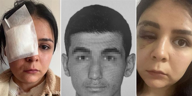 Yoldan geçen kıza yumruk atan saldırgan tutuklandı