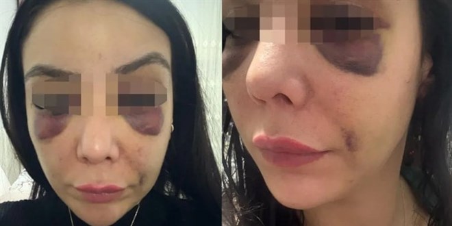 Lisanslı kick boksçu iş arkadaşını darp etti
