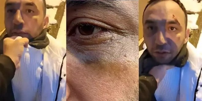 Eski sevgiliye yeni sevgili tuzağı... Yaşadığı dehşeti anlattı