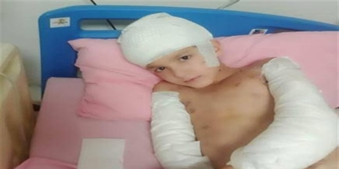Başıboş köpek saldırısında 2 Keçiören Belediye personeli yargılanıyor