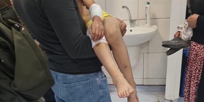 9 ya��ndaki �ocu�a ba��bo� k�pekler sald�rd�