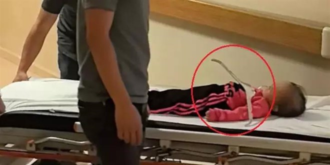 2 yaşındaki Meryem'in oynadığı askı çenesine saplandı