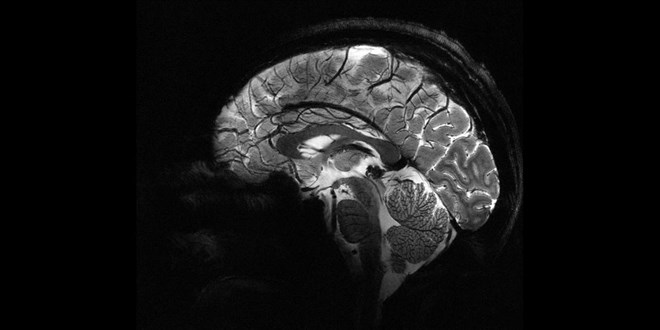 Pandemi beyinleri h�zla ya�land�rd�