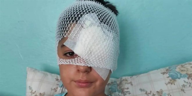 Başıboş köpek saldırısından kaçan çocuğa otomobil çarptı