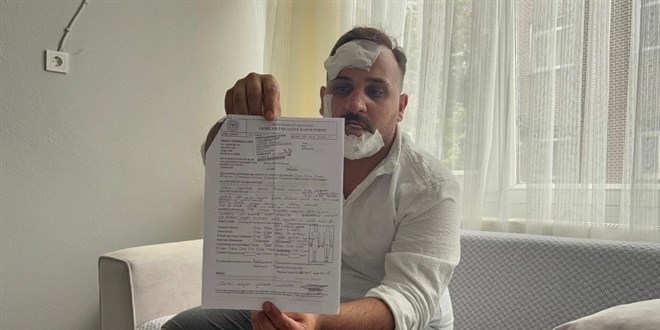 Taksi ofr Eski Szlsnn Sevgilisi Polislerce Dvld ddias