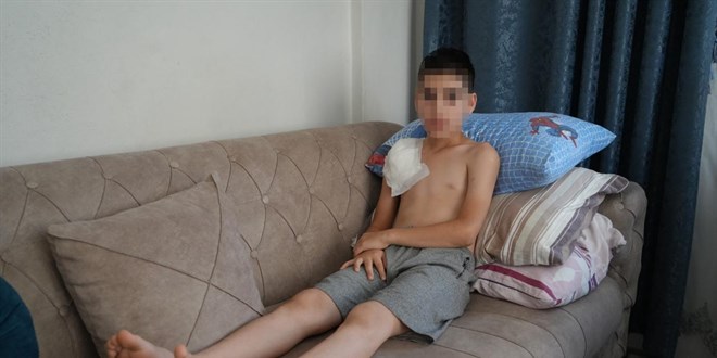 Samsun'da kpein saldrd 11 yandaki ocuun kolu fel kald