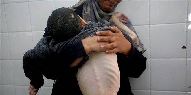 Gazze'de 5 ayl�k bir bebek daha a�l�ktan hayat�n� kaybetti